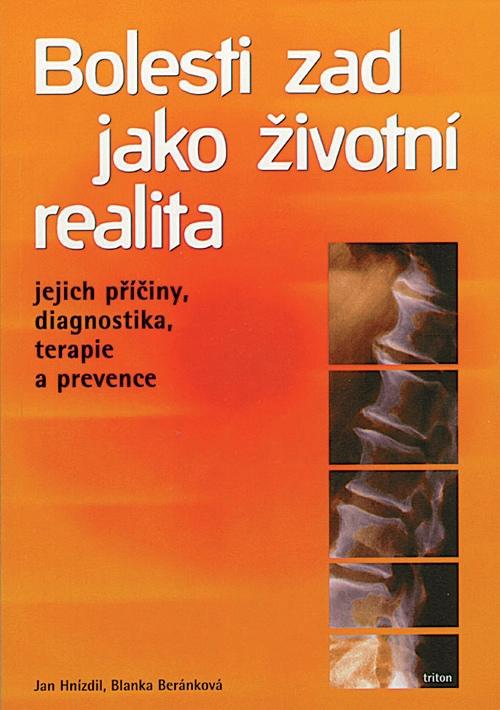 Obrazok Bolesti zad jako životní realita