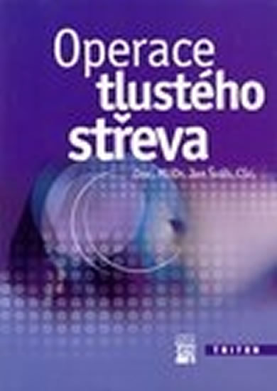 Obrázok Operace tlustého střeva