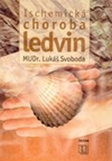 Obrázok Ischemická choroba ledvin