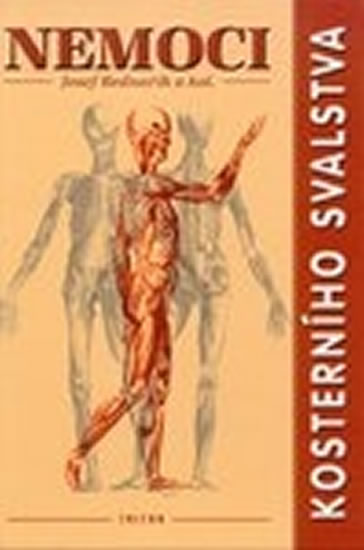 Obrázok Nemoci kosterního svalstva