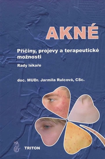 Obrázok Akné - Příčiny, projevy a terapeutické možnosti