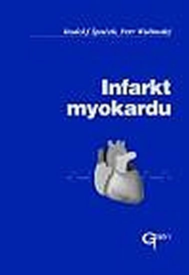 Obrázok Infarkt myokardu