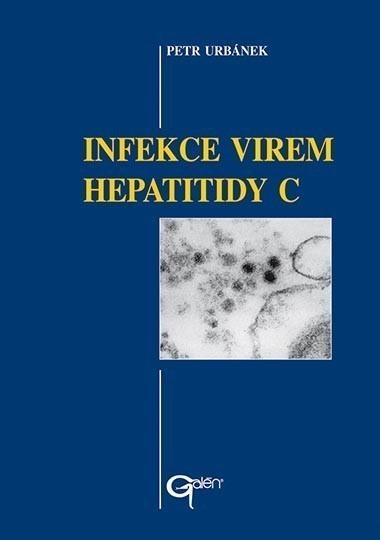 Obrazok Infekce virem hepatitidy C