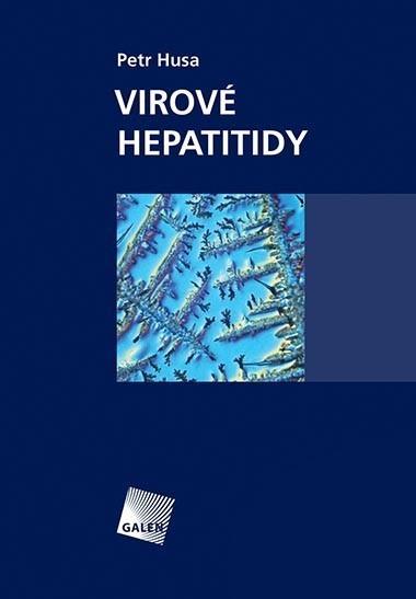 Obrazok Virové hepatitidy