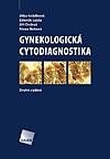 Obrázok Gynekologická cytodiagnostika