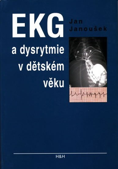 Obrázok EKG a dysrytmie v dětském věku (Praktický návod k diagnostice a léčbě)