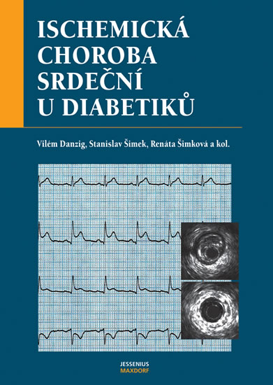 Obrázok Ischemická choroba srdeční u diabetiků