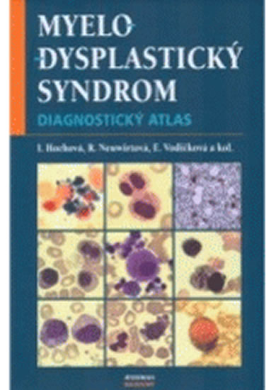 Obrázok Myelodysplastický syndrom - Diagnostický atlas