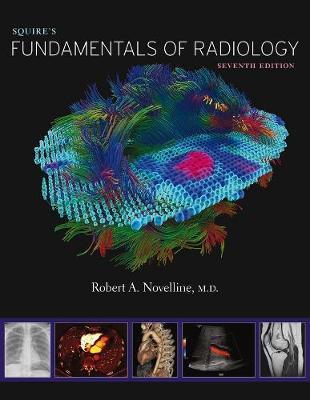 Obrázok Squires Fundamentals of Radiology