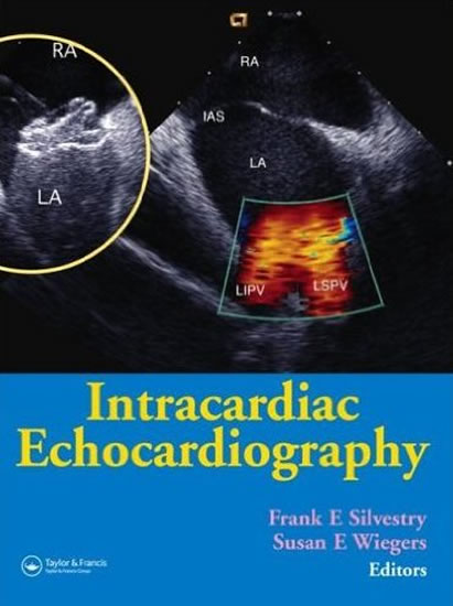 Obrázok Intracardiac Echocardiography