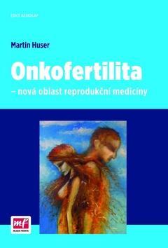 Obrázok Onkofertilita - nová oblast reprodukční medicíny
