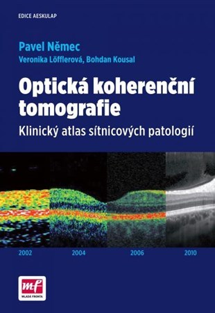 Obrázok Optická koherenční tomografie - Klinický atlas sítnicových patologií