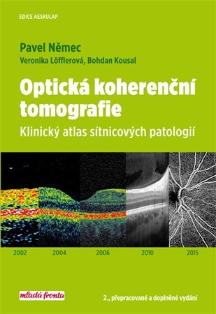 Obrázok Optická koherenční tomografie - Klinický atlas sítnicových patologií