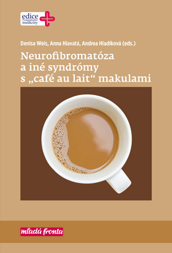 Obrázok Neurofibromatóza a iné syndromy s „café au lait“ makulami