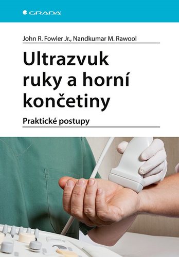 Obrázok Ultrazvuk ruky a horní končetiny