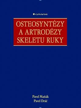 Obrázok Osteosyntézy a artrodézy skeletu ruky
