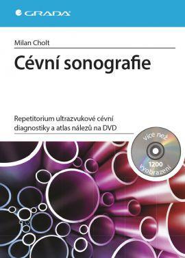 Obrázok Cévní sonografie