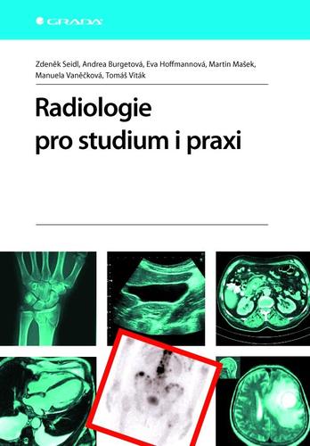 Obrázok Radiologie pro studium i praxi