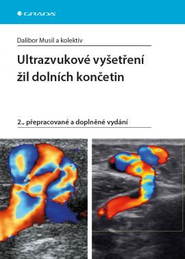 Obrázok Ultrazvukové vyšetření žil dolních končetin - 2.vydání