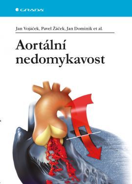 Obrázok Aortální nedomykavost