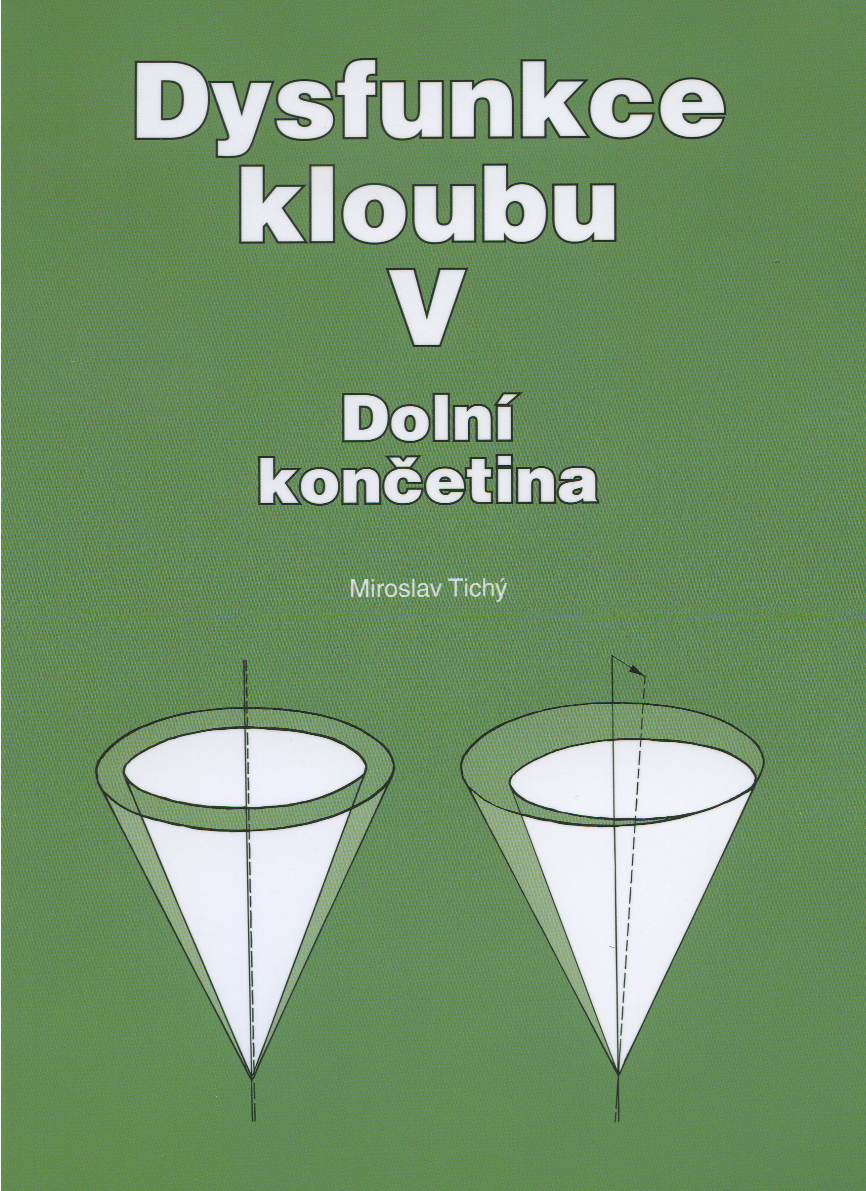 Obrazok Dysfunkce kloubu V. - Dolní končetina