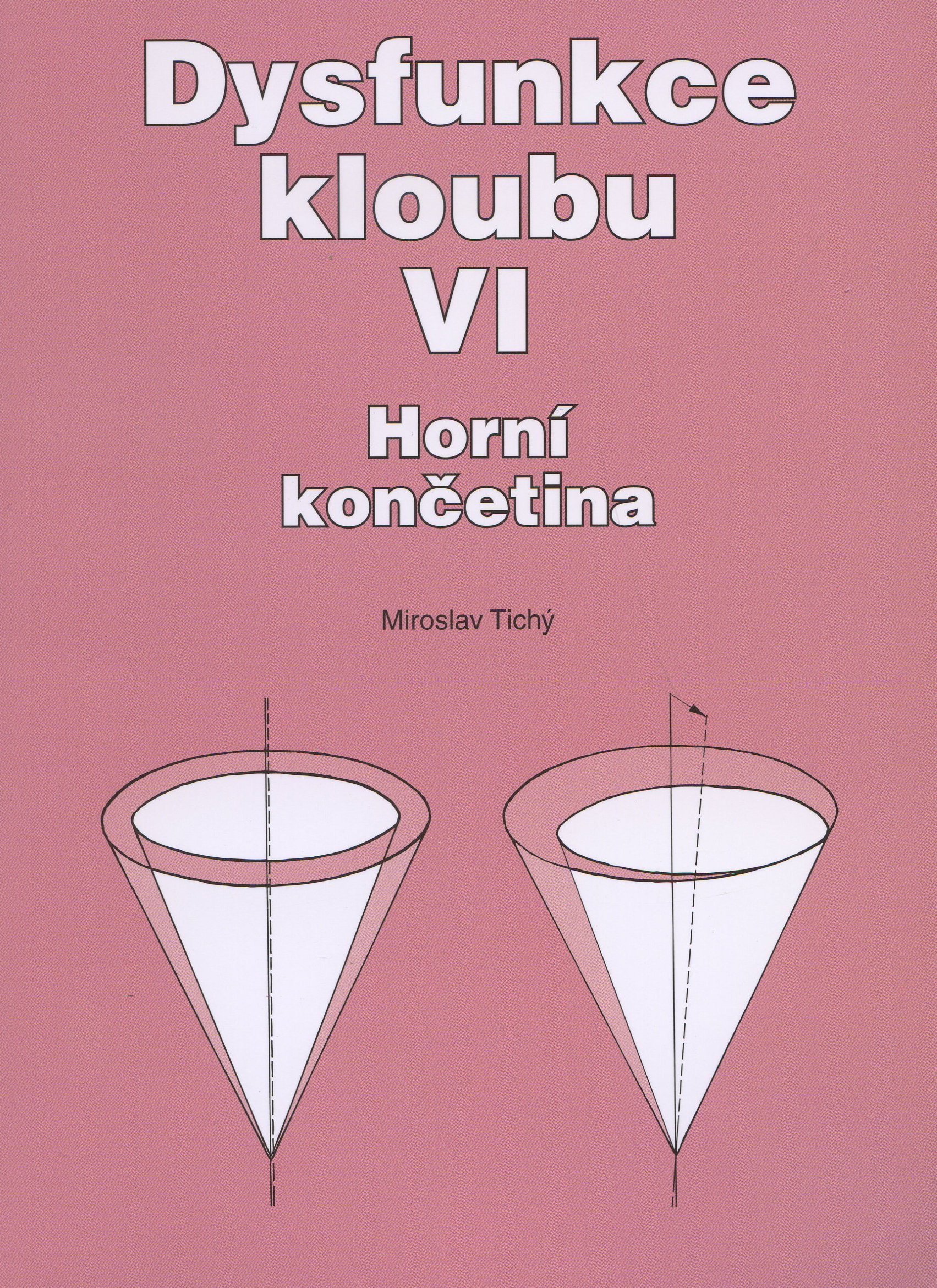 Obrazok Dysfunkce kloubu VI. - Horní končetina