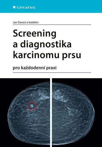 Obrázok Screening a diagnostika karcinomu prsu pro každodenní praxi