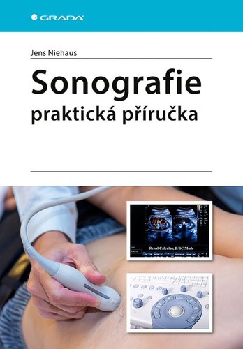 Obrázok Sonografie