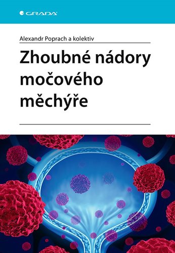 Obrázok Zhoubné nádory močového měchýře