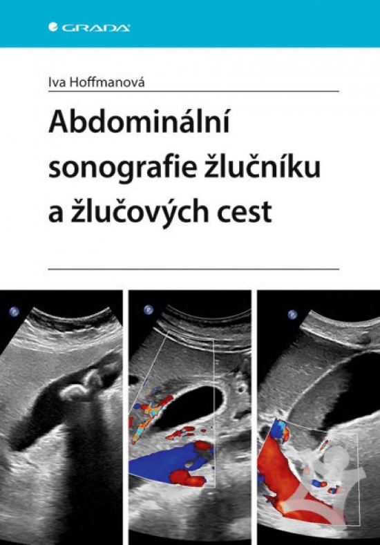 Obrázok Abdominální sonografie žlučníku a žlučových cest