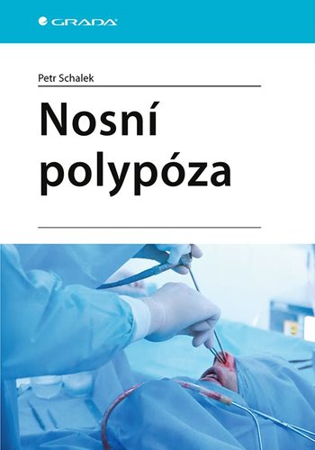 Obrázok Nosní polypóza