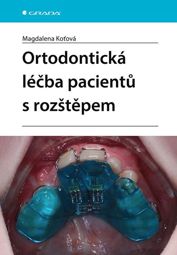 Obrázok Ortodontická léčba pacientů s rozštěpem
