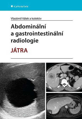 Obrázok Abdominální a gastrointestinální radiologie