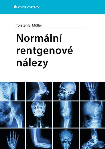 Obrázok Normální rentgenové nálezy