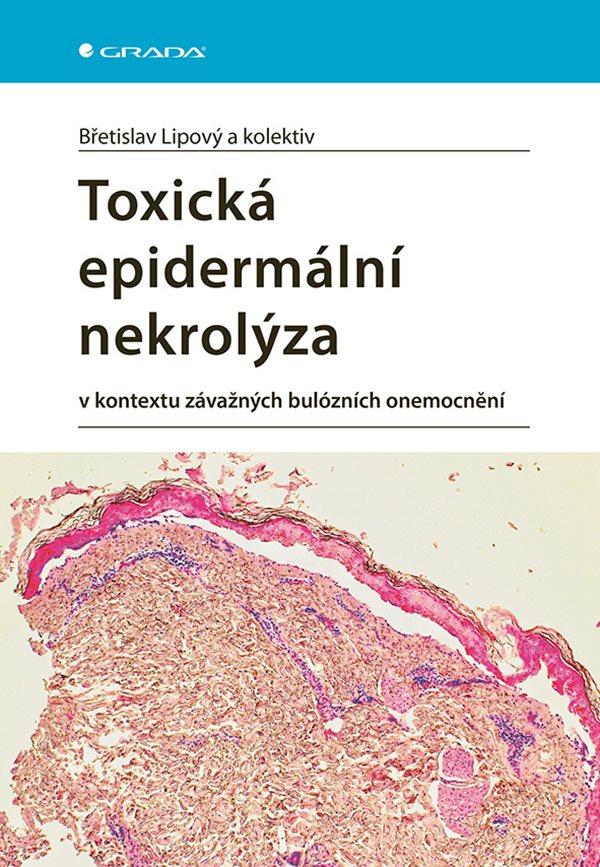 Obrázok Toxická epidermální nekrolýza