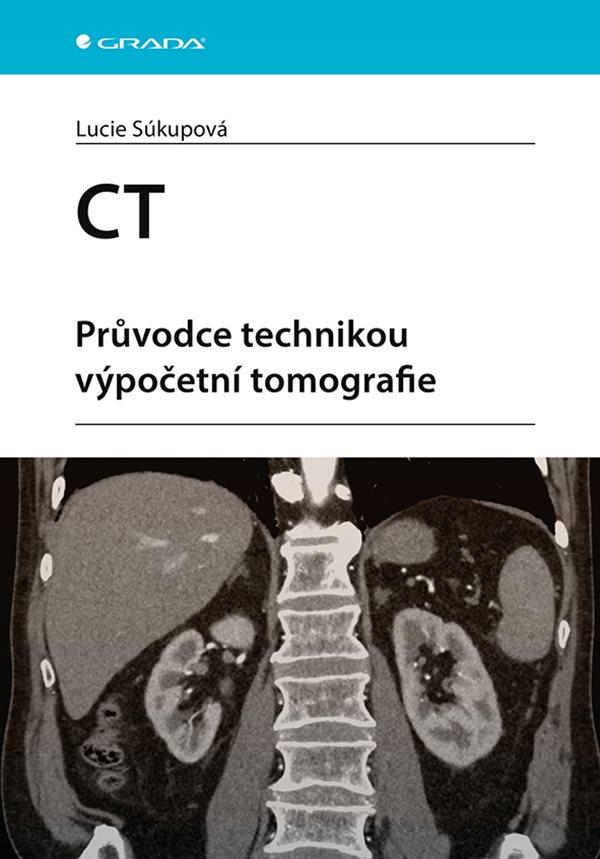 Obrázok CT - Průvodce technikou výpočetní tomografie