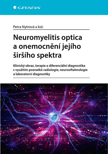Obrázok Neuromyelitis optica a poruchy jejího širšího spektra