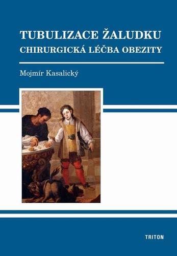 Obrázok Tubulizace žaludku