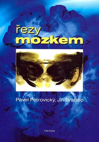 Obrázok Řezy mozkem - Anatomické, , mikroskopické a magnetické