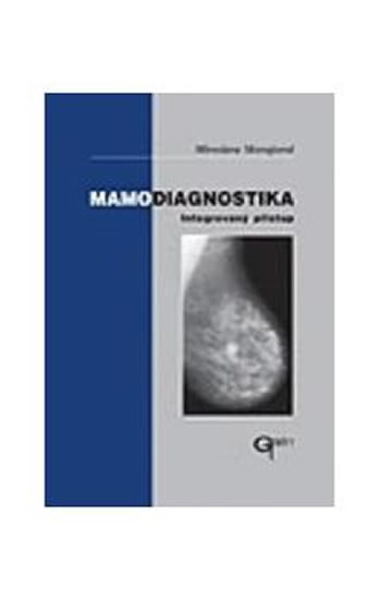 Obrázok Mamodiagnostika