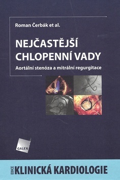 Obrázok Nejčastější chlopenní vady