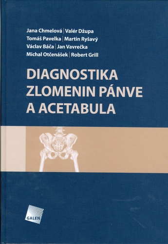 Obrázok Diagnostika zlomenin pánve a acetabula