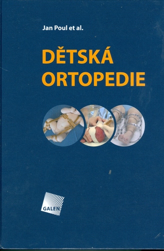 Obrázok Dětská ortopedie