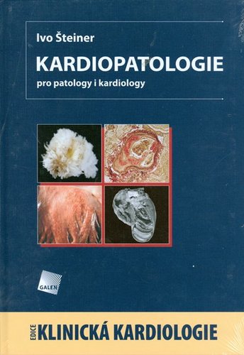 Obrázok Kardiopatologie