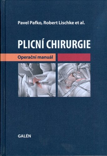 Obrázok Plicní chirurgie