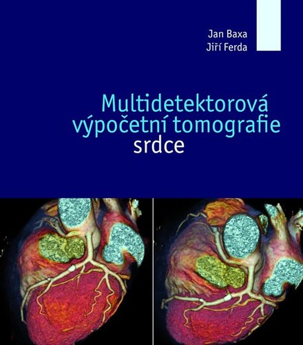 Obrázok Multidetektorová výpočetní tomografie sr