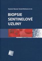 Obrázok Biopsie sentinelové uzliny