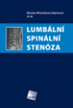 Obrázok Lumbální spinální stenóza