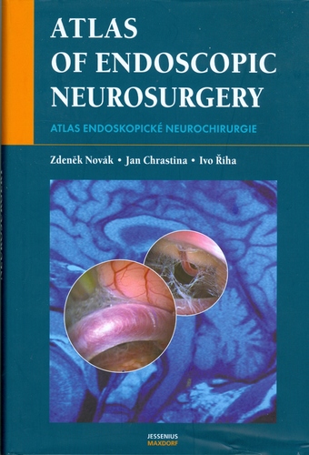 Obrázok Atlas endoskopické neurochirurgie