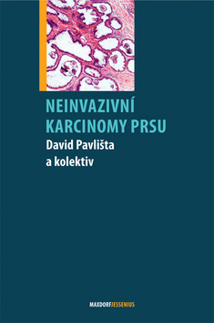 Obrázok Neinvazivní karcinomy prsu